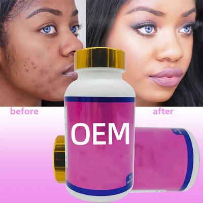 OEM ग्लूटाथियोन त्वचा सफेद करने वाली गोलियां 60pcs/Soft Gel